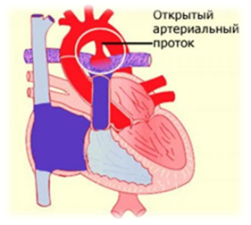 Пороки сердца. Анализ течения беременности и родов у женщин с пороками сердца.