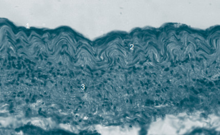 Гистотопограмма каудальной полой вены в грудной полости суточного ягненка. Гематоксилин и эозин, Микмед-5, ок. 10, об. 40 1 - внутренняя оболочка; 2-средняя оболочка; 3 - наружная оболочка.
