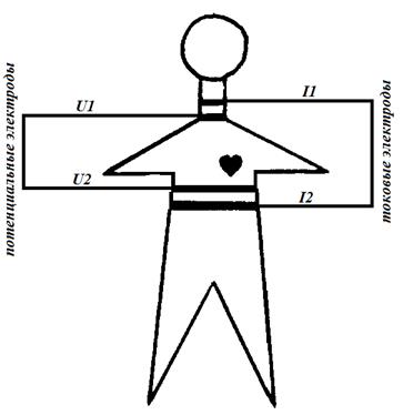 Тетраполярная схема наложения электродов.