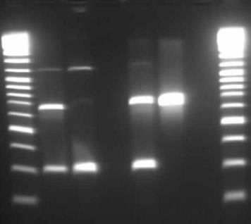 Рис. 16 Фотография фрагмента 1,5% агарозного геля, содержащего электрофоретически разогнанные продукты ПЦР с использованием праймеров DTF - DTR и AmyF1 - AmyR1 к последовательностям фрагментов tox и amy генов C. Diphtheriae.