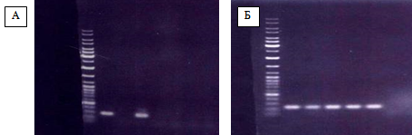Рисунок 7 Фотография фрагмента 1,5% агарозного геля, содержащего электрофоретически разогнанные продукты ПЦР с использованием праймеров DIP03531F - DIP03541R к последовательности фрагмента локуса DIP0353 - DIP0354 (А) и продукты ПЦР с использованием праймеров DIP03532F - DIP03532R к последовательности фрагмента гена DIP0353 (Б) C. Diphtheriae.