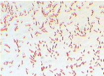 Citrobacter freundii под микроскопом.