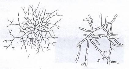 Мицелий актиномицета (1) и гриба (2) при одинаковом увеличении.
