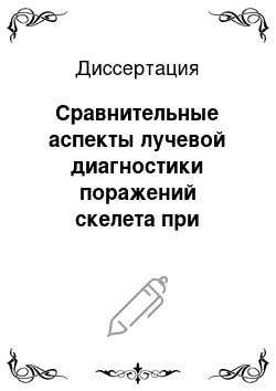 Диссертация: Сравнительные аспекты лучевой диагностики поражений скелета при миеломной болезни