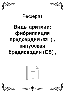 Реферат: Виды аритмий: фибрилляция предсердий (ФП) , синусовая брадикардия (СБ) , пароксизмальная желудочковая (ПЖ) тахикардия