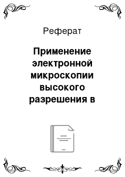 Реферат: Применение электронной микроскопии высокого разрешения в физике твердого тела