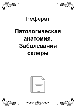 Реферат: Патологическая анатомия. Заболевания склеры