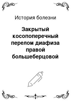 История болезни: Закрытый косопоперечный перелом диафиза правой большеберцовой кости в нижней трети