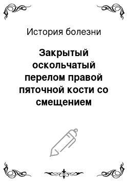 История болезни: Закрытый оскольчатый перелом правой пяточной кости со смещением