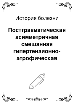 История болезни: Посттравматическая асимметричная смешанная гипертензионно-атрофическая гидроцефалия с нарастанием внутренней гидроцефалии